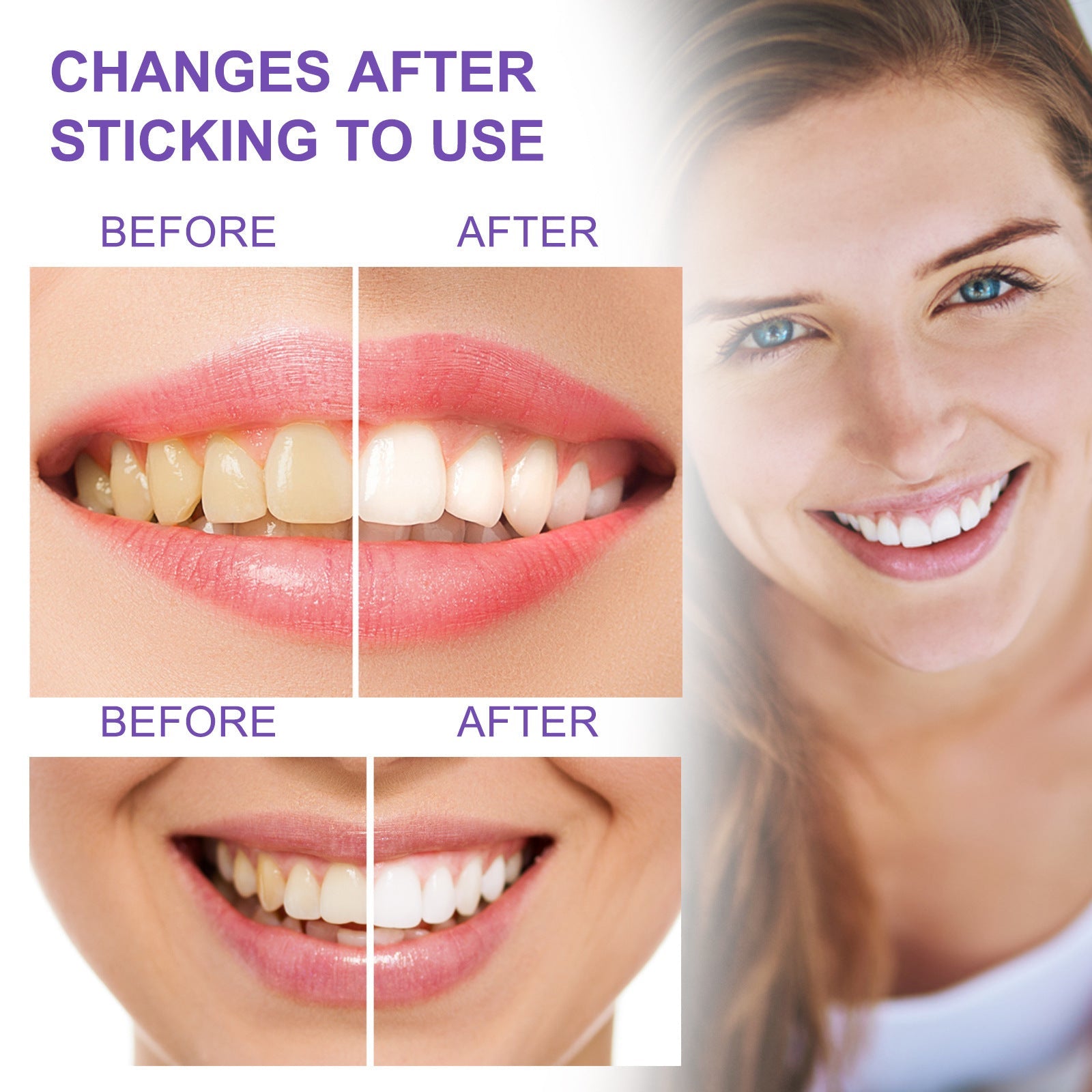 Teeth Whitening Toothpaste Whitening Teeth Removal - My Store