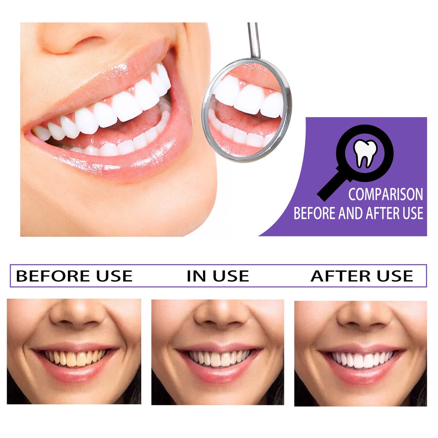 Teeth Whitening Toothpaste Whitening Teeth Removal - My Store