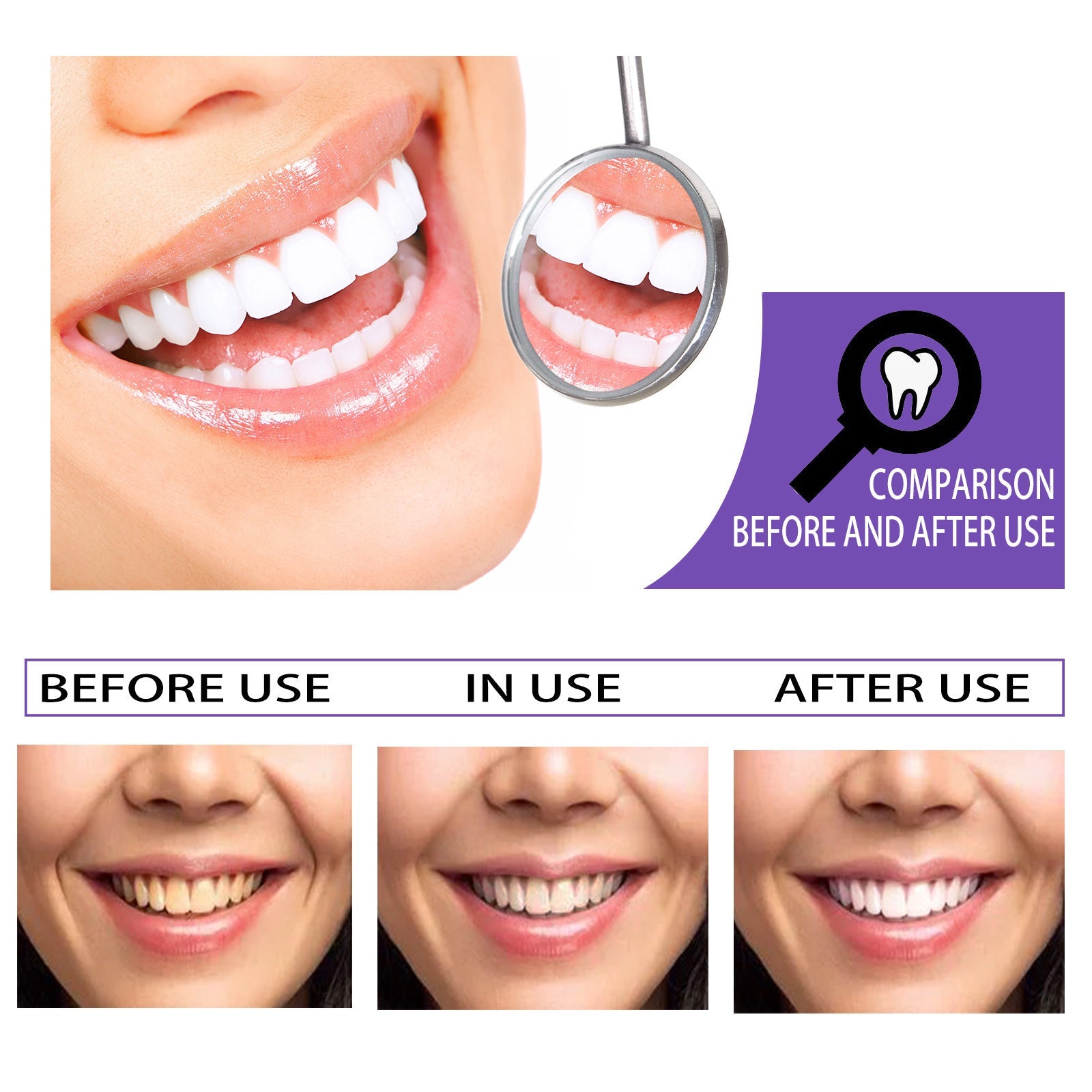 Teeth Whitening Toothpaste Whitening Teeth Removal - My Store